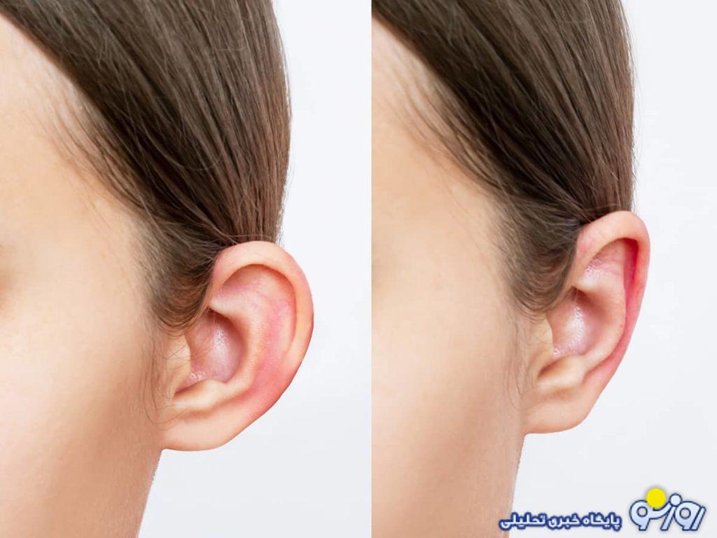 عمل اتوپلاستی چیست و چه کسانی نیاز به آن دارند؟ عمل اتوپلاستی چیست و چه کسانی نیاز به آن دارند؟